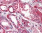 PSPH Antibody (aa1-225, clone 3G12)